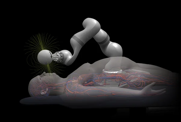 Magnendo Awarded Up to $32M by ARPA-H to Advance Autonomous Robotic Stroke Intervention